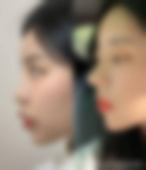 南京宁美整形医疗美容门诊部价格表（仅供参考）