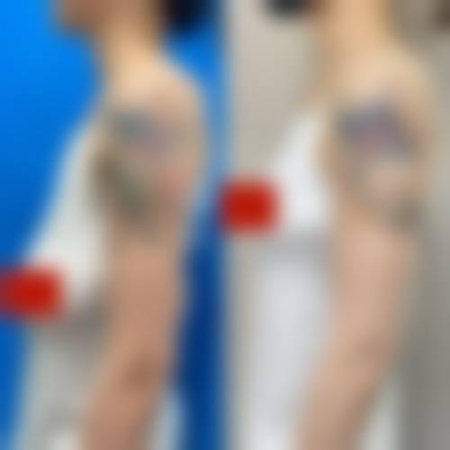 泰州泰兴柏丽整形医院实例参考