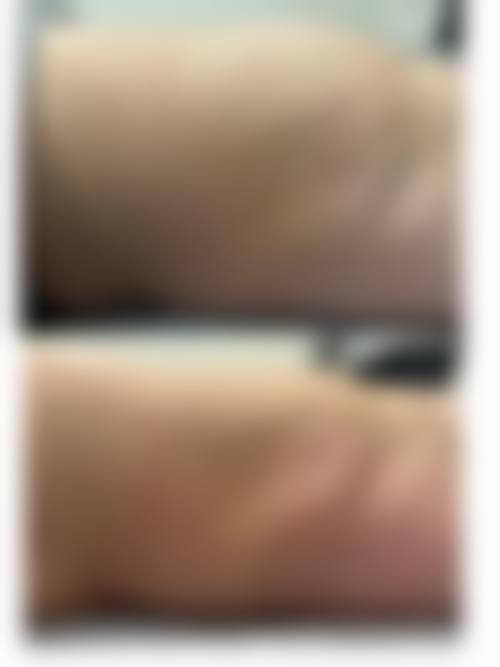 南京宁美整形医疗美容门诊部实例参考