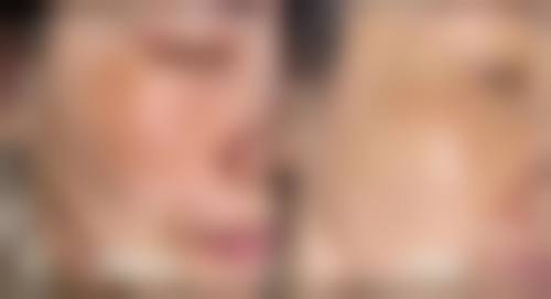 湘南美容 千叶SEN CITY院价格表（仅供参考）