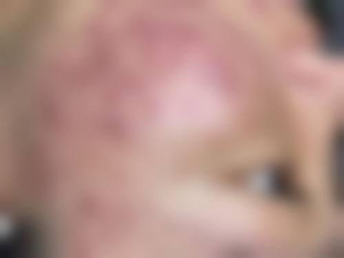 韩国The Sulleim皮肤科医院价格表（仅供参考）