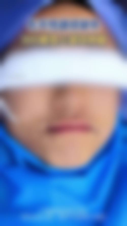 武汉显赫植发医院实例参考