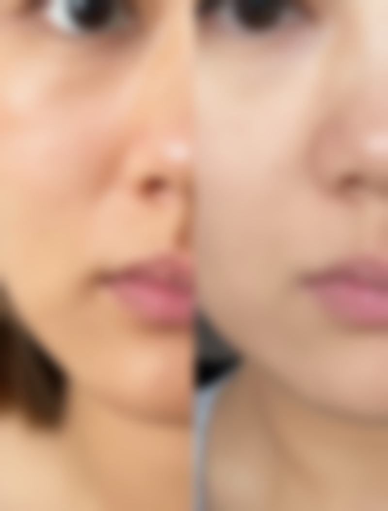 湘南美容 千叶SEN CITY院实例参考