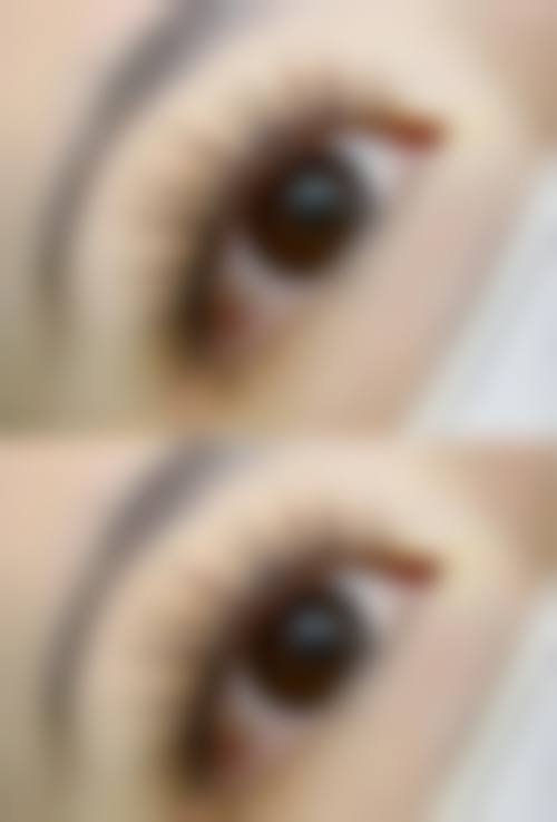 复旦大学附属华东医院(整形外科)价格表（仅供参考）