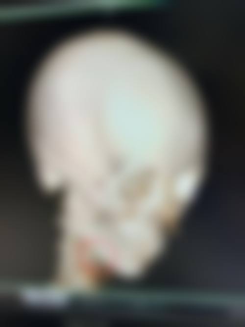 长春市盛羽国内外医美整形怎么预约？