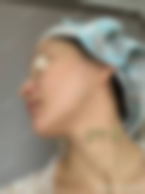 长春市盛羽国内外医美整形价格表（仅供参考）