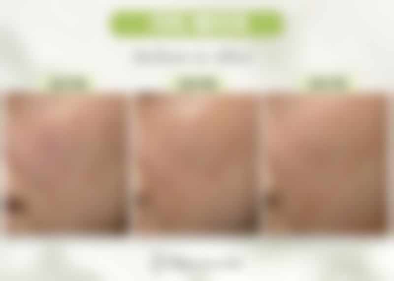 韩国Shinebom皮肤科基本信息