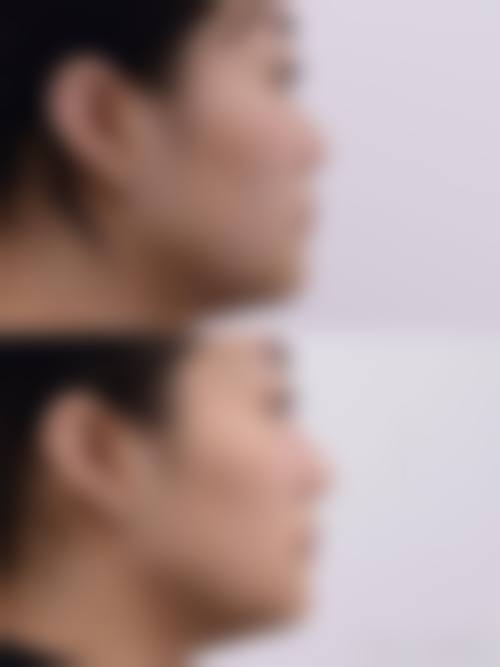 宇部美容外科价格表（仅供参考）