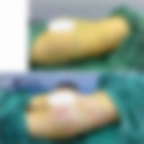 宇部美容外科实例参考