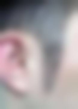 昆山新生植发价格表（仅供参考）