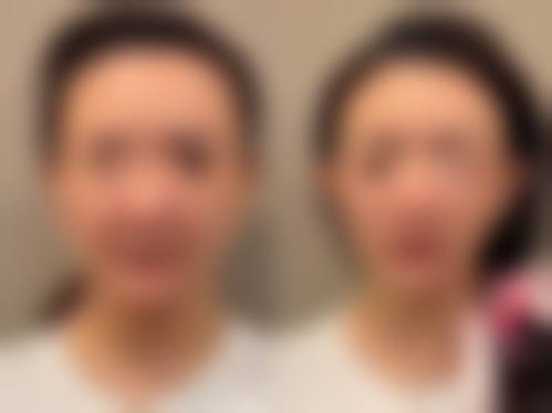 新余耀美医疗美容门诊部擅长项目