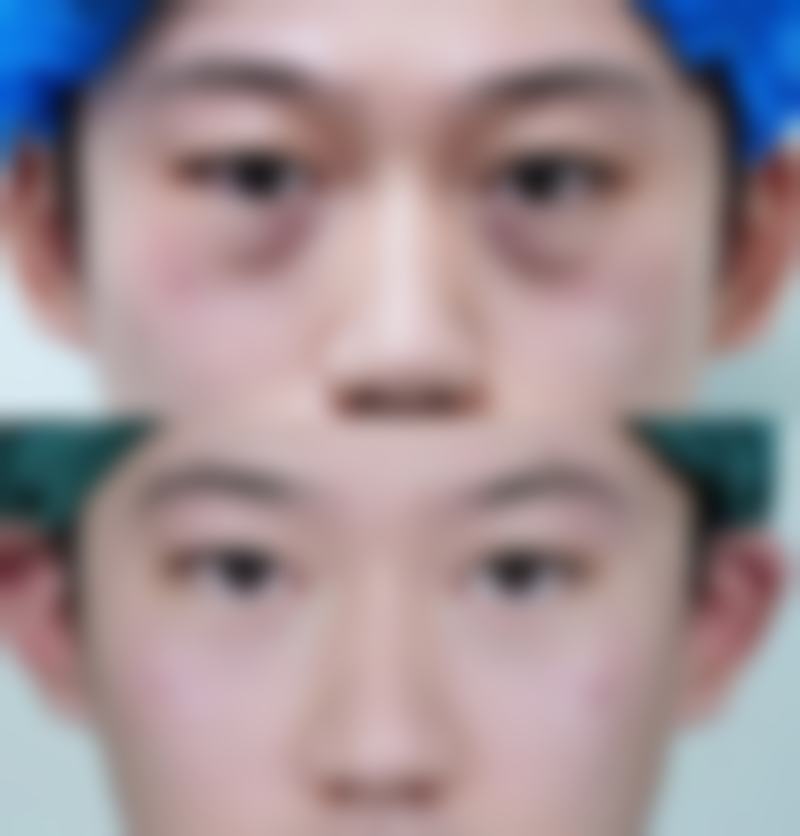 阜阳琴瑟医疗整形美容门诊部价格表（仅供参考）