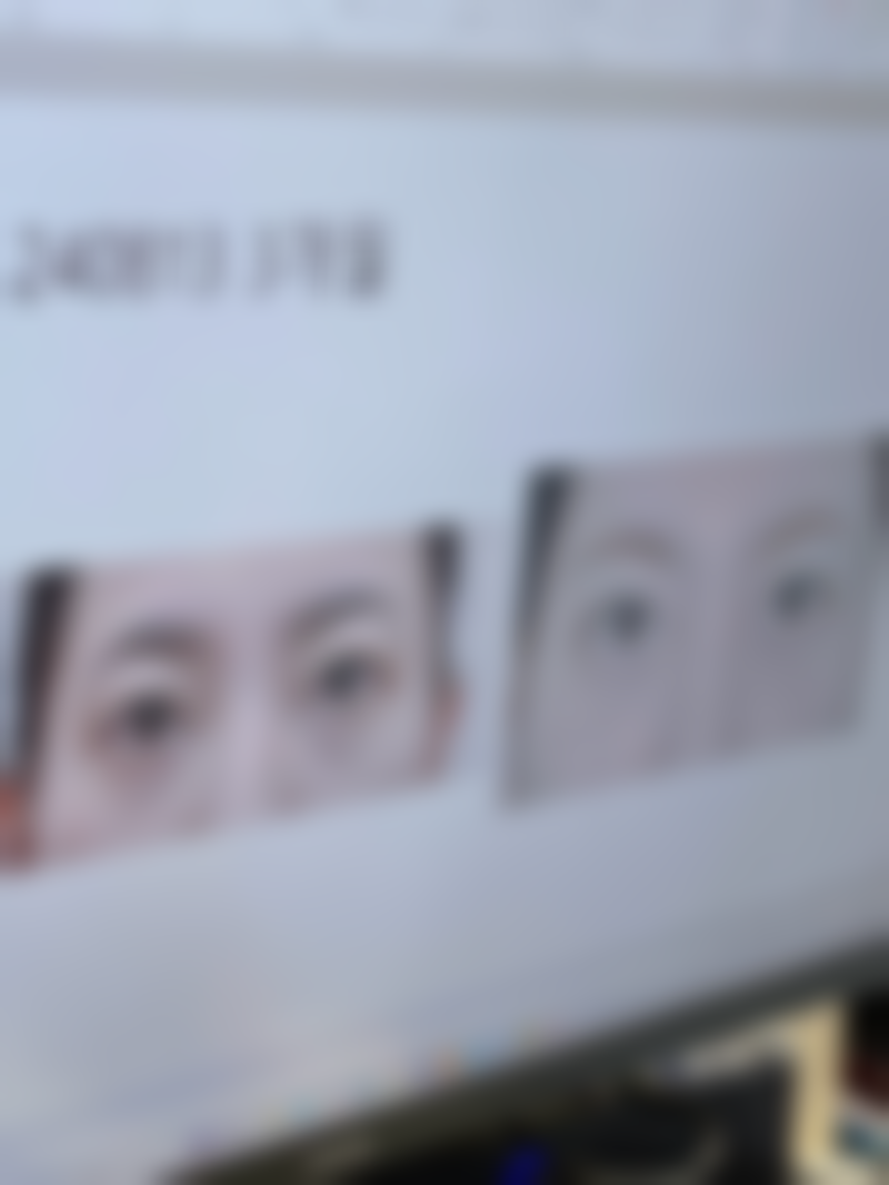 桂林熊名田医疗美容实例参考