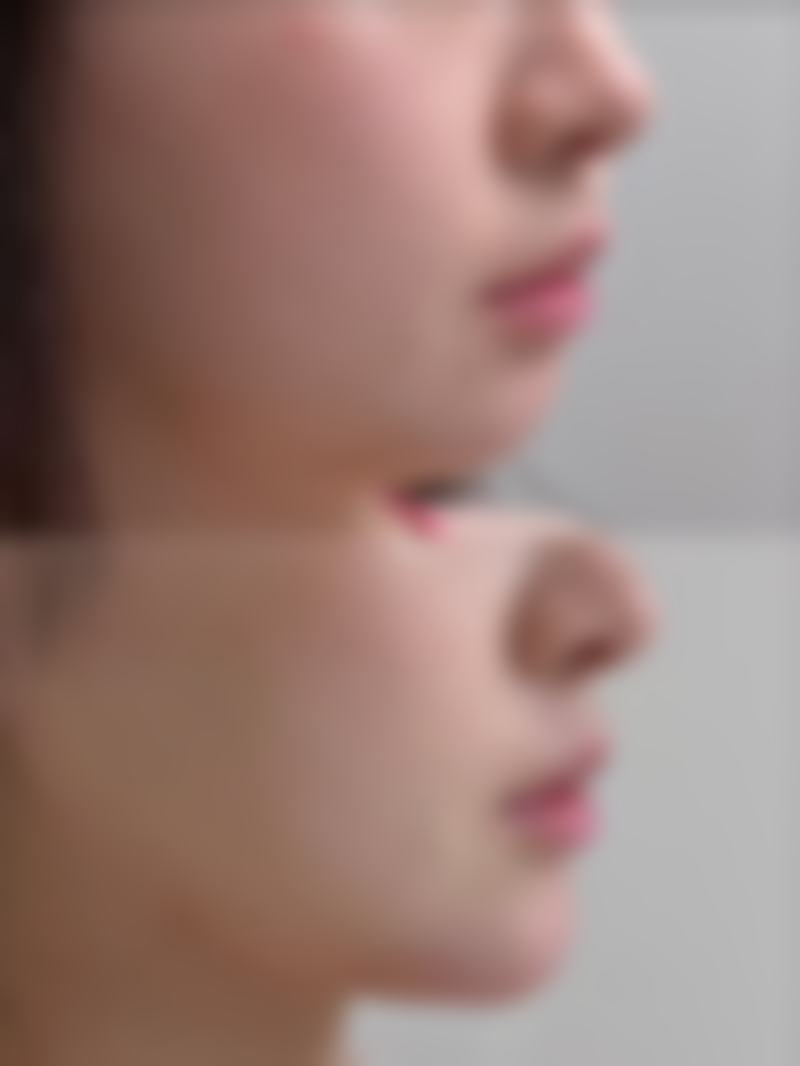 西安柏港医疗美容诊所价格表（仅供参考）