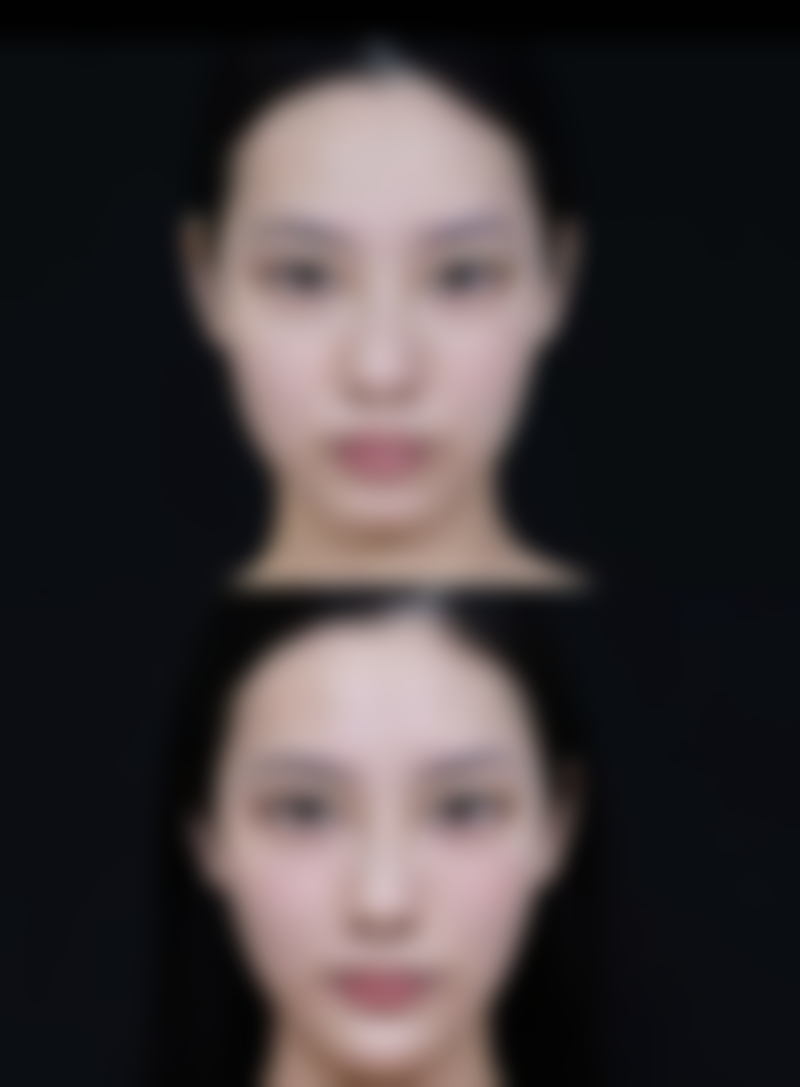 承德韩博仕医疗美容诊所价格表（仅供参考）