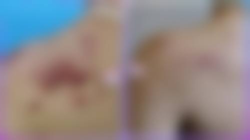 河池市人民医院烧伤整形外科擅长项目