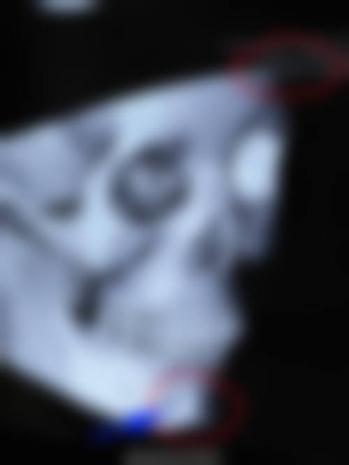 成都簇芳笺医疗美容诊所价格表（仅供参考）