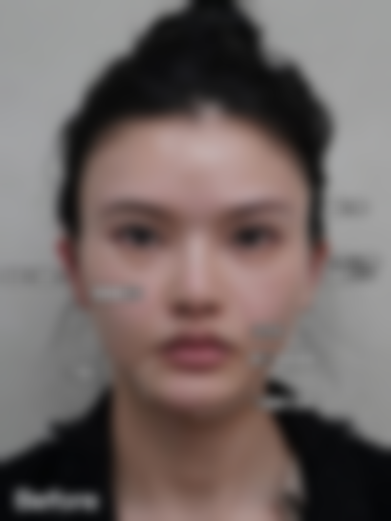 西安艺星朱彬芳医生的常见项目收费参考