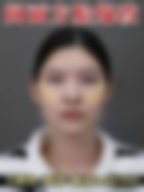 天津华美整形医疗美容医院实例参考