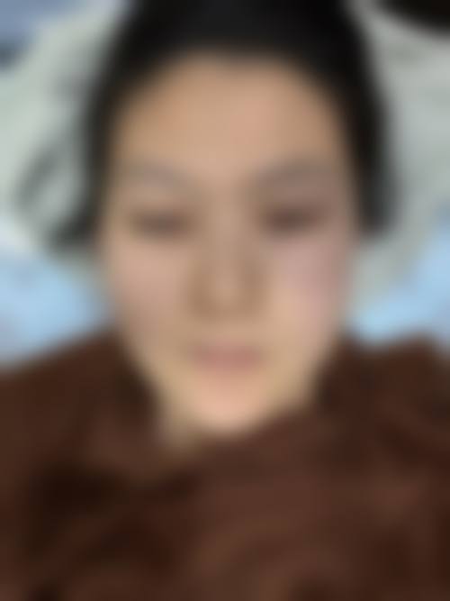 南昌华瑞医疗美容医院价格表（仅供参考）