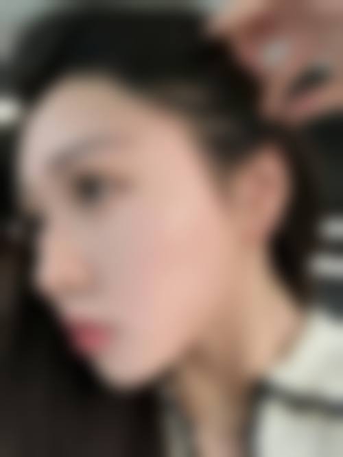 长沙华美整形美容医院实例参考