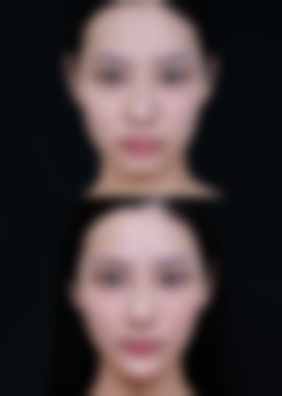 长沙华美整形美容医院怎么预约?