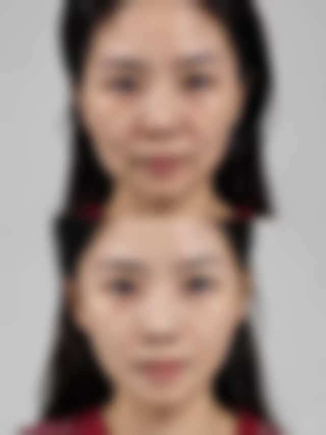 淄博媄妍医疗美容实例参考