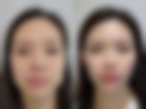 北京易美丽医疗美容诊所擅长项目