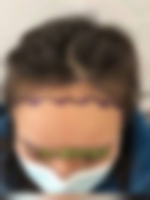 温州雍禾植发医疗美容门诊部价格表（仅供参考）