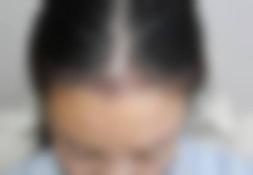 温州雍禾植发医疗美容门诊部擅长项目