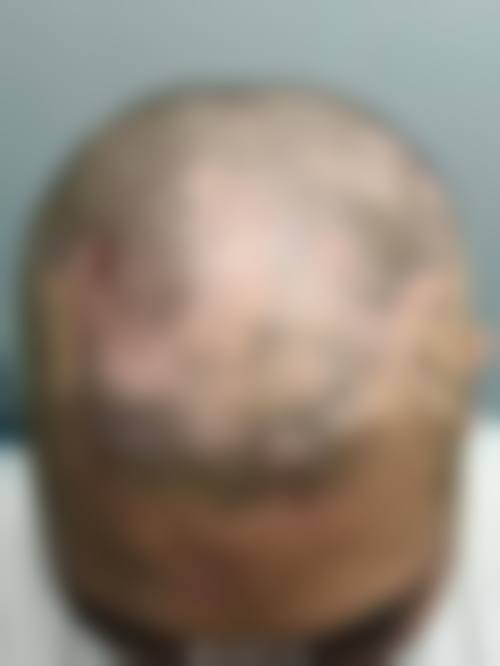 温州雍禾植发医疗美容门诊部医生有哪些？