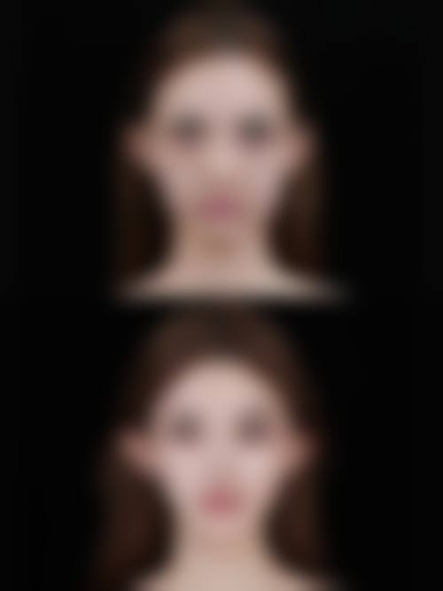 北京易美丽医疗美容诊所价格表(仅供参考)