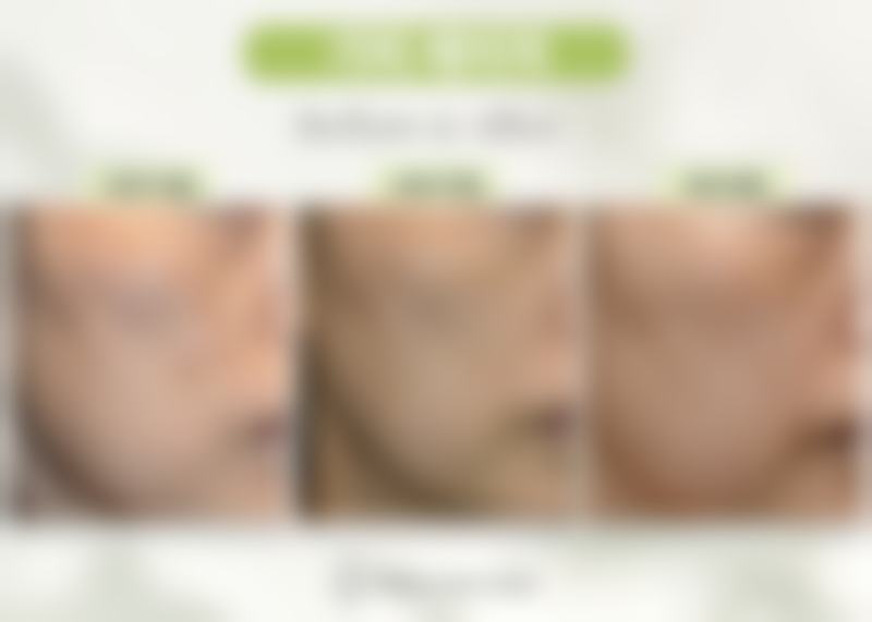 韩国shinebom皮肤科地址及到院路线