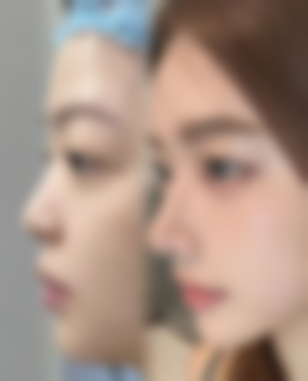 浙江省人民医院整形外科怎么预约?