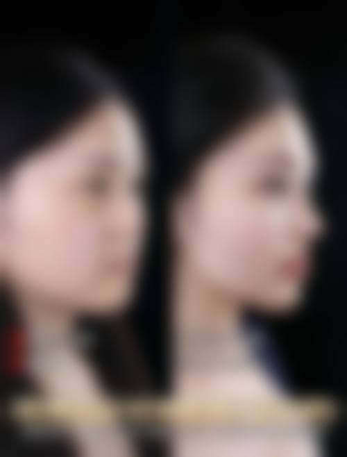 盐城市比尔吉美整形美容医生有哪些？