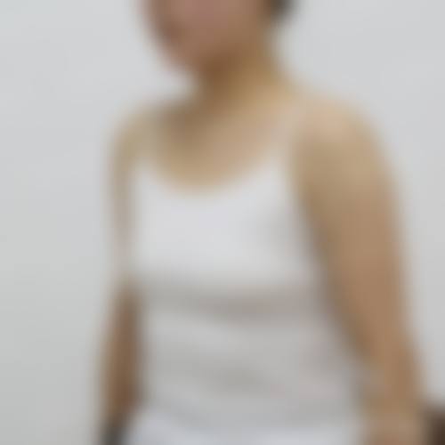 韩国水滴整形外科实例参考