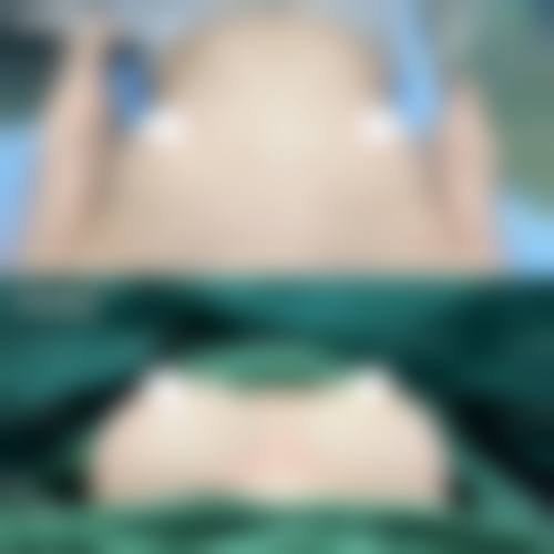 盐城市比尔吉美整形美容怎么预约？