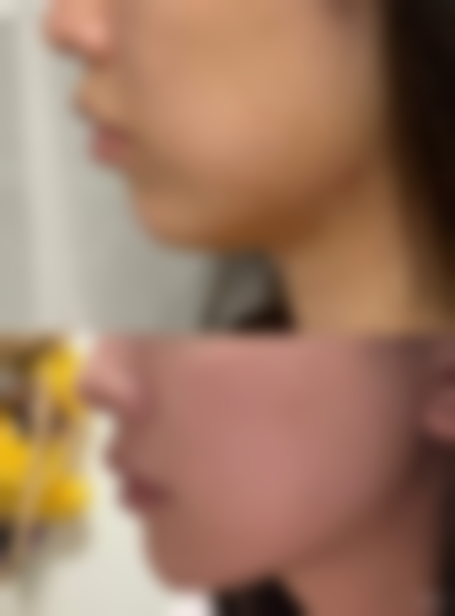 江汉油田总医院整形美容外科实例参考