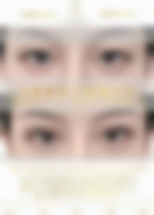 龙江县添一整形医院擅长项目