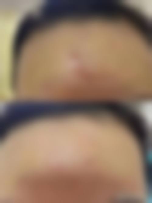 龙江县添一整形医院实例参考