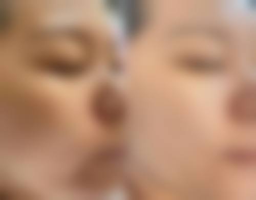 江苏徐州玖瑜睛禧整形医院擅长项目