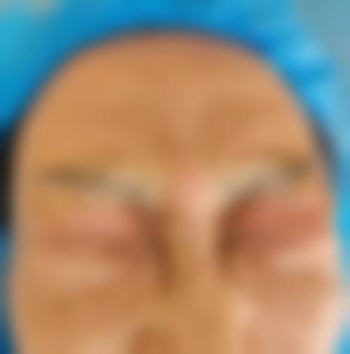 成都零维度医疗美容诊所价格表（仅供参考）