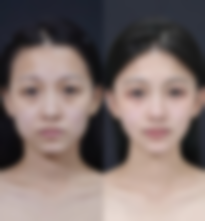 东莞美极媄琳医疗美容诊所实例参考