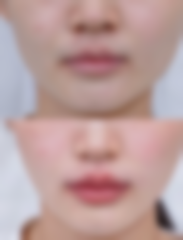 东莞美极媄琳医疗美容诊所价格表（仅供参考）