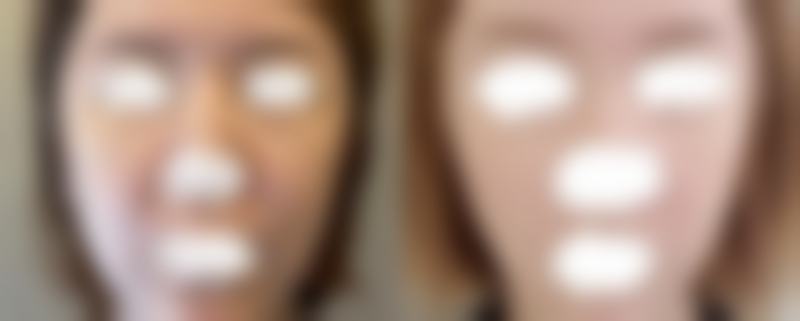 韩国Bone整形外科怎么预约？