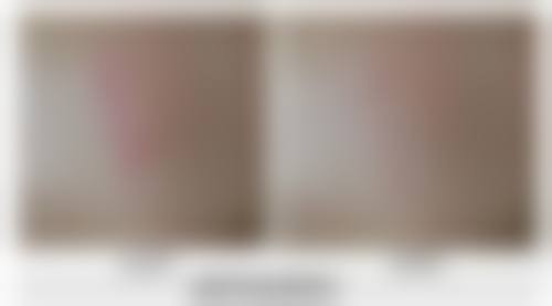 林京首患者评价