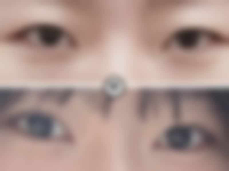 徐州新沂艾美医疗美容门诊部价格表（仅供参考）