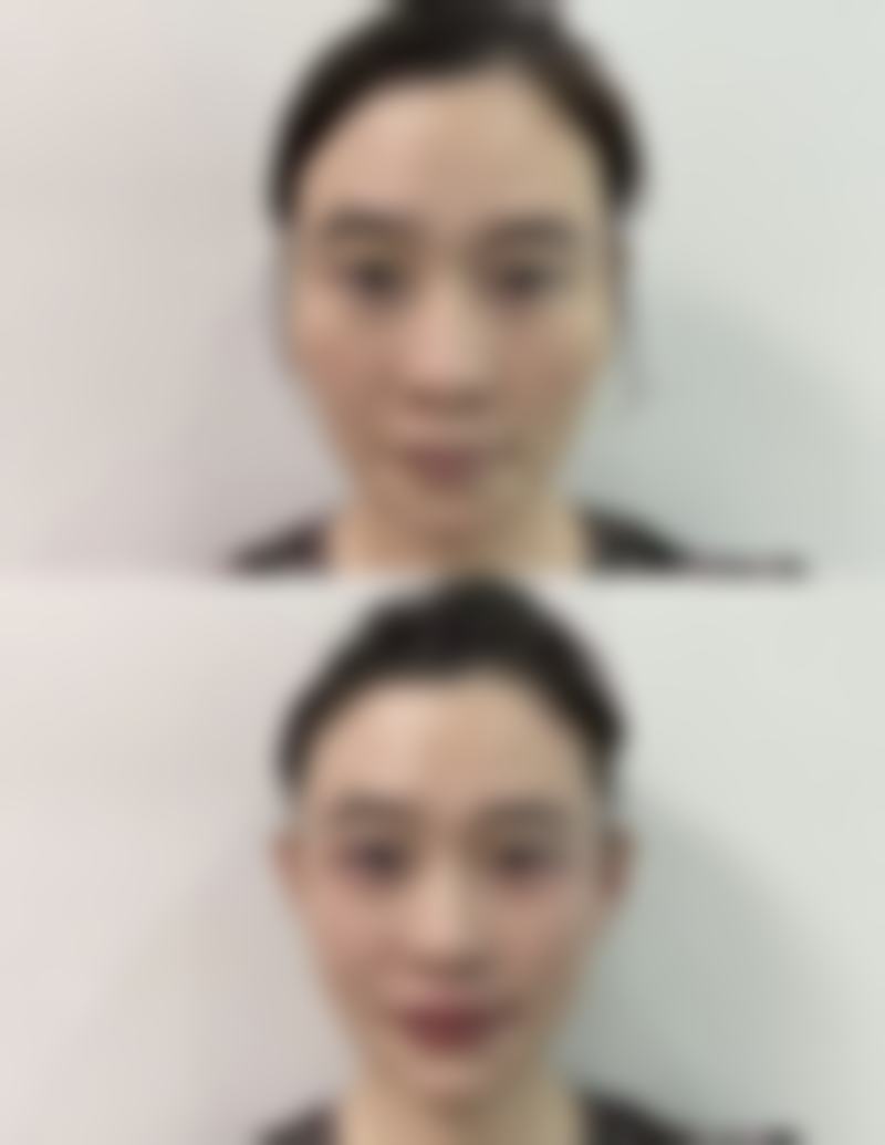 南宁美初医疗美容门诊部地址及到院路线