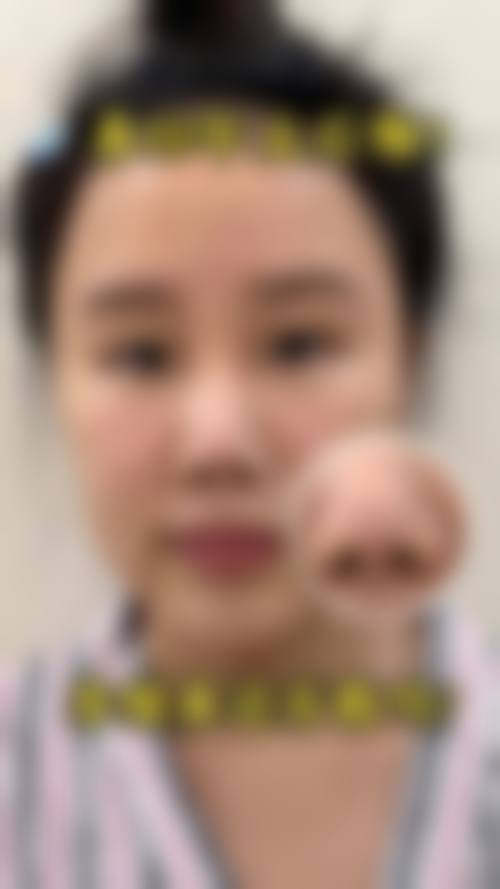 南宁市第一人民医院整形美容外科怎么预约？