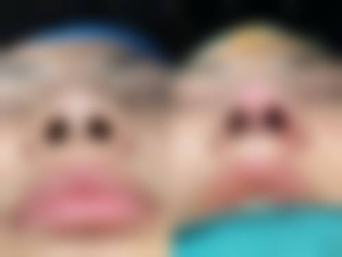 南宁市第一人民医院整形美容外科擅长项目